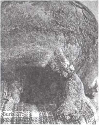 Рис. 6. Фрагмент черепа с левой глазницей